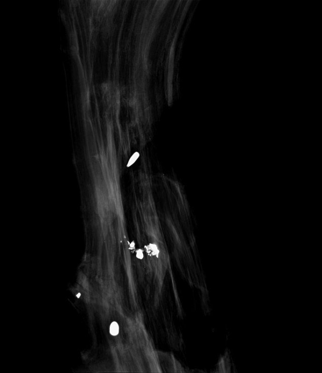 Morten Barker: X-ray 2013, 50x60 cm, 3 mm dibond.